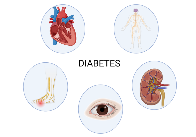 Diabetes effects on body