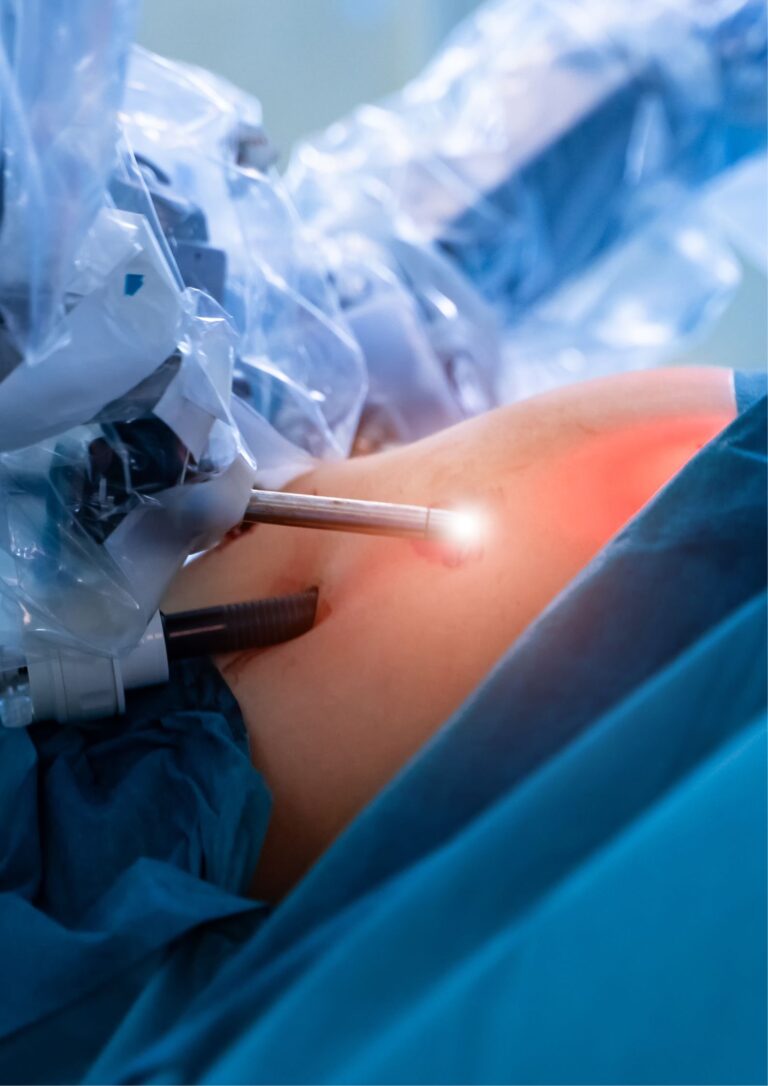 Dive into the world of bariatric surgery with our insightful blog. Understand what it is, its types, benefits, considerations, and the research surrounding it, all presented in an easy-to-understand format