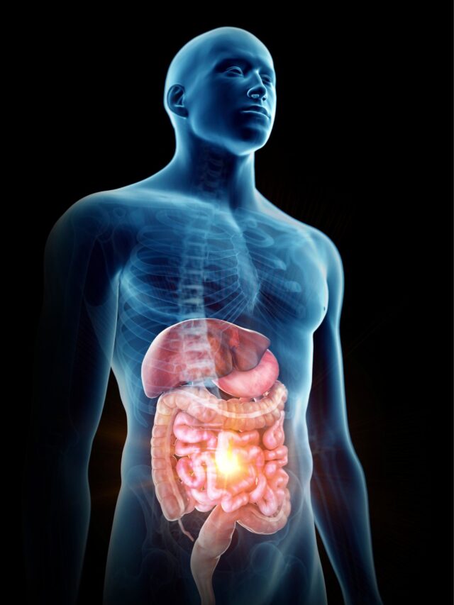 Whats behind the cause of Inflammatory Bowel Disease (IBD)